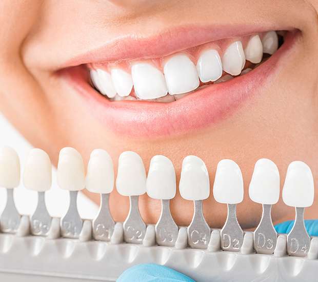 Best discount cosmetic dentist