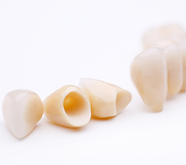 Lemoore Dental Crowns and Dental Bridges