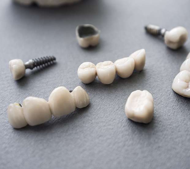Lemoore The Difference Between Dental Implants and Mini Dental Implants
