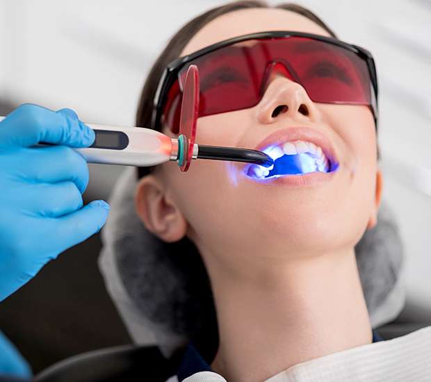 Lemoore Professional Teeth Whitening